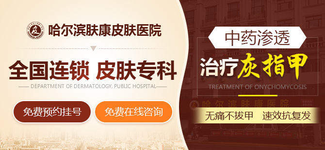 哈尔滨治疗灰指甲医院