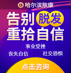 哈尔滨脱发专科治疗医院:脱发治疗费用高吗